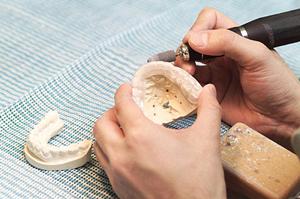 インプラント治療で有名な堺市の歯科