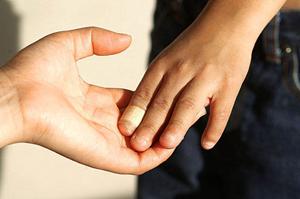 南大阪で安心のインプラント治療を実現!最新技術と信頼の医療を徹底解説