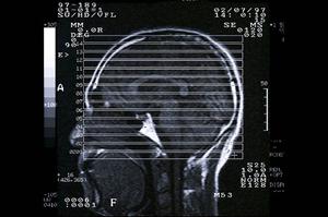 内科小児科のある大林町の井上医院